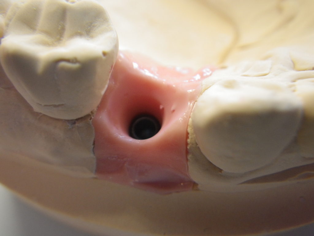 上部構造を模型から外したところです。