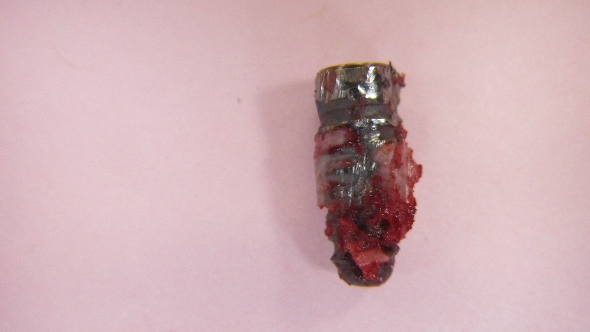 除去したインプラントです